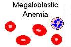 Megaloblastic Anemia